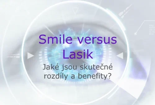 ReLEX SMILE versus femto LASIK